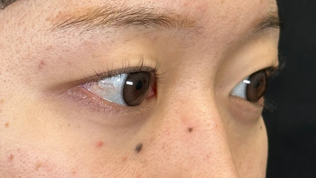 Preoperative Condition Part 1