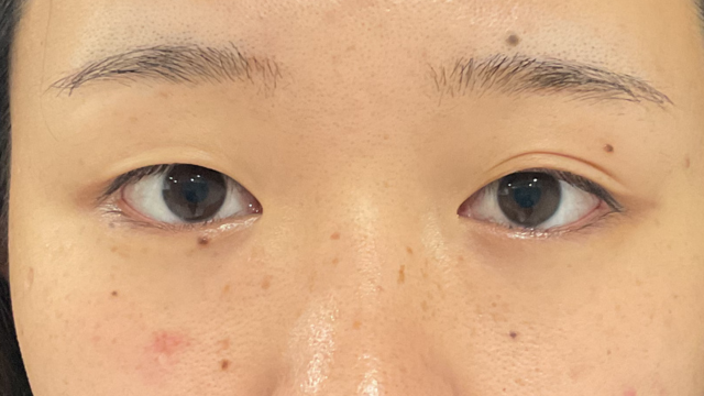 Preoperative Condition Part 1