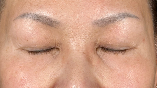 Preoperative Condition Part 1