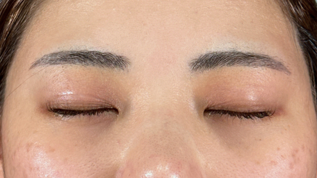 Preoperative Condition Part 1