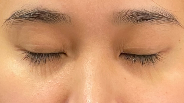 Preoperative Condition Part 1