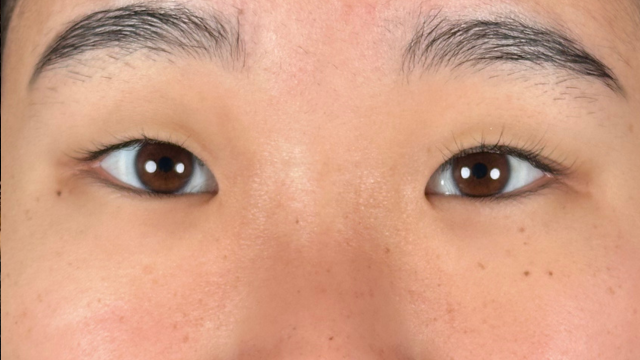 Preoperative Condition Part 1