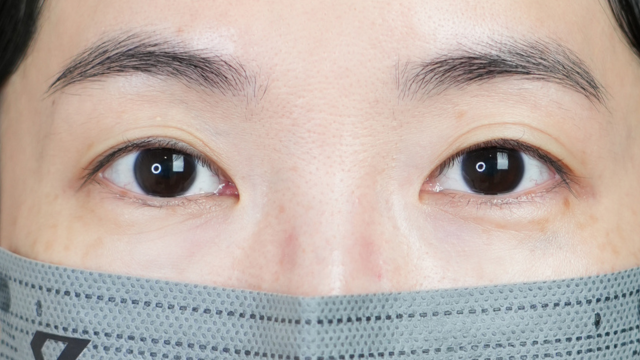 Preoperative Condition Part 1