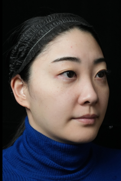 Preoperative Condition Part 1