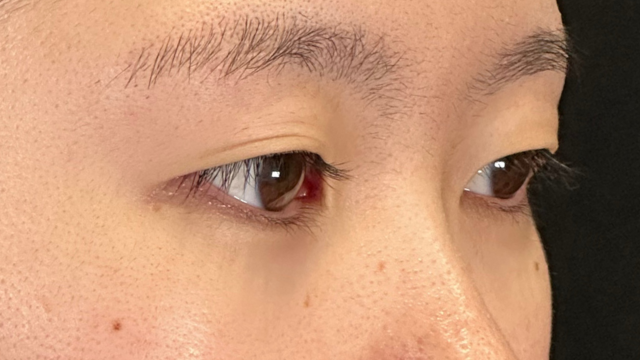 Preoperative Condition Part 1