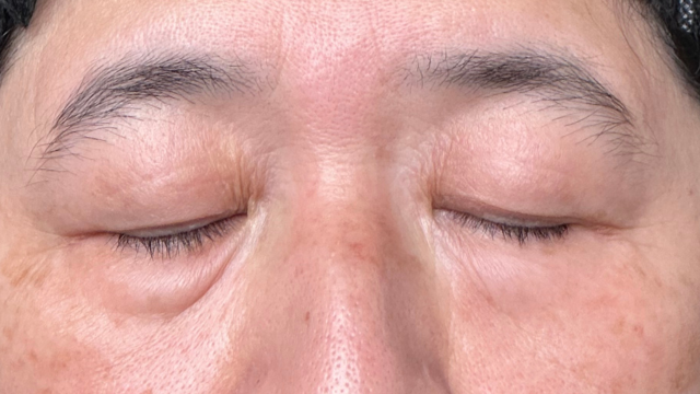 Preoperative Condition Part 1