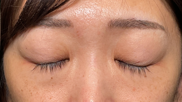 Preoperative Condition Part 1