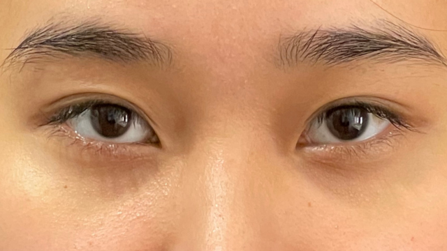 Preoperative Condition Part 1