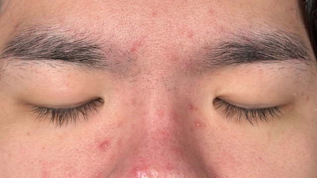 Preoperative Condition Part 1