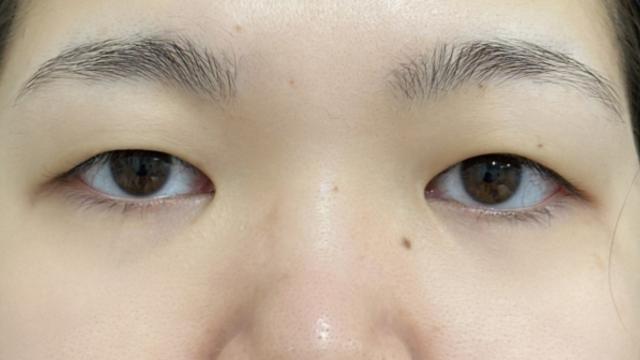 Preoperative Condition Part 1