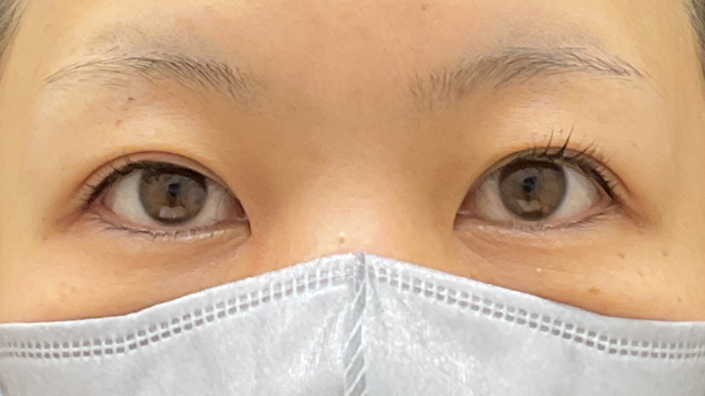 Preoperative Condition Part 1