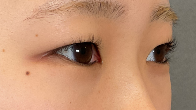 Preoperative Condition Part 1