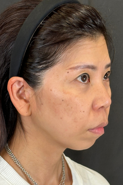 Preoperative Condition Part 1