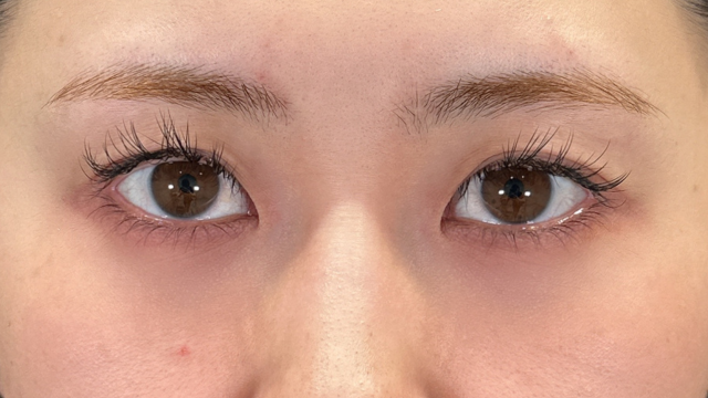 Preoperative Condition Part 1