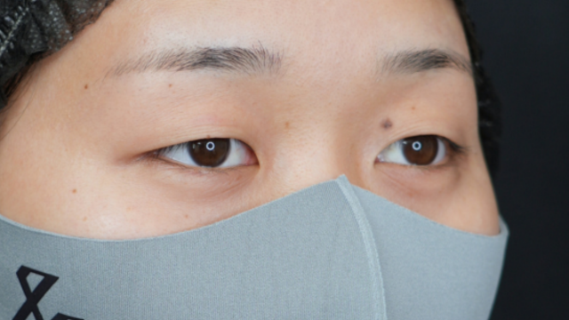 Preoperative Condition Part 1