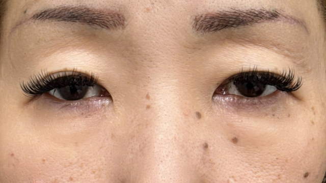 手术前的状态 其一