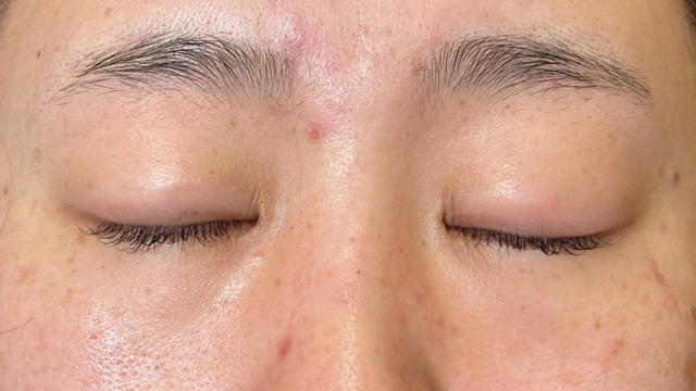 Preoperative Condition Part 1