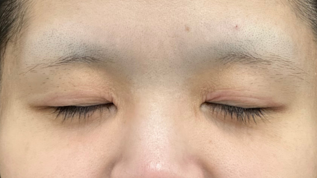 Preoperative Condition Part 1