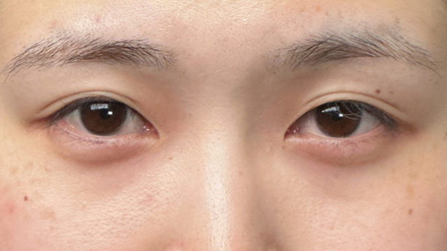 Preoperative Condition Part 1