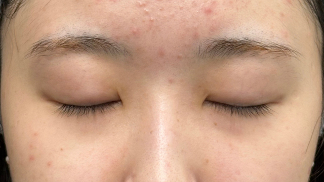 Preoperative Condition Part 1