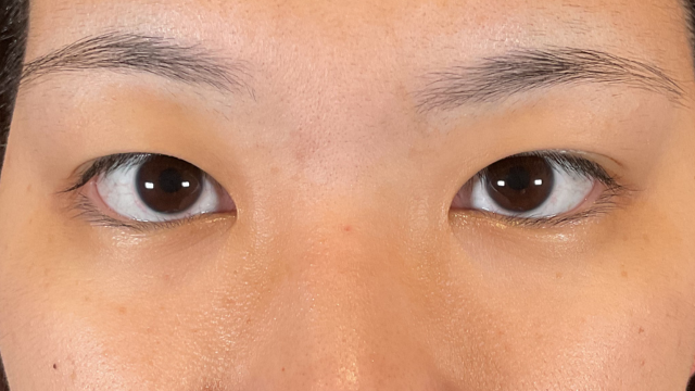 Preoperative Condition Part 1