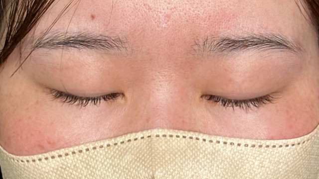 Preoperative Condition Part 1