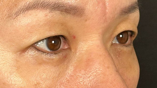 Preoperative Condition Part 1