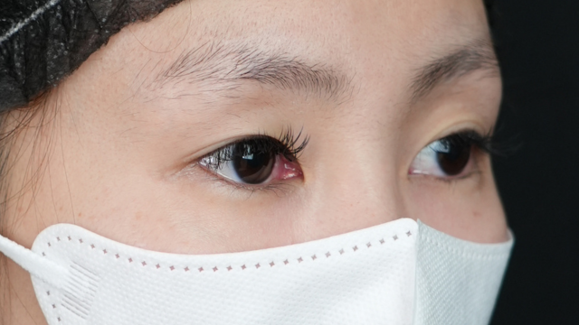 Preoperative Condition Part 1