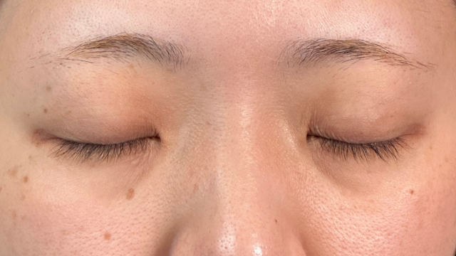 Preoperative Condition Part 1