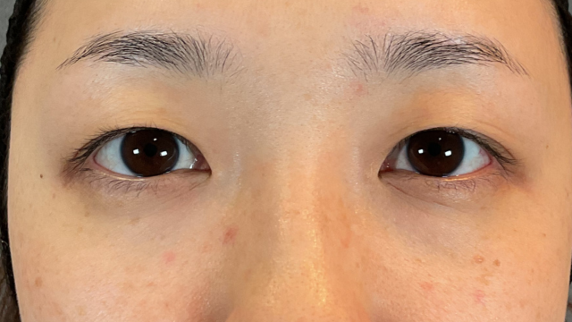 Preoperative Condition Part 1