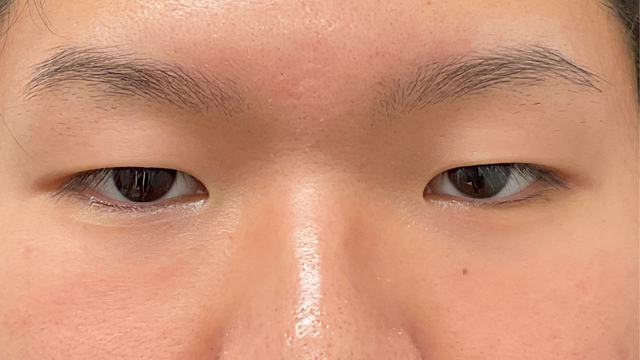 Preoperative Condition Part 1