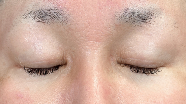 Preoperative Condition Part 1