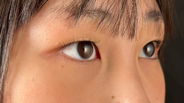 Preoperative Condition Part 1