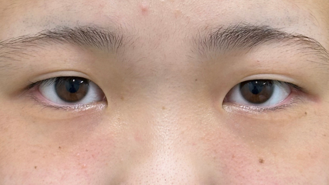 Preoperative Condition Part 1