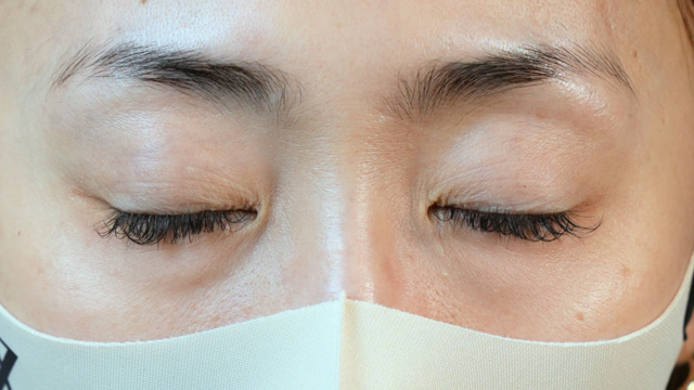 Preoperative Condition Part 1