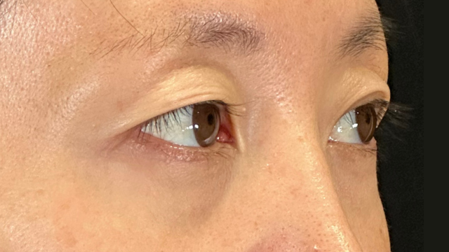 Preoperative Condition Part 1