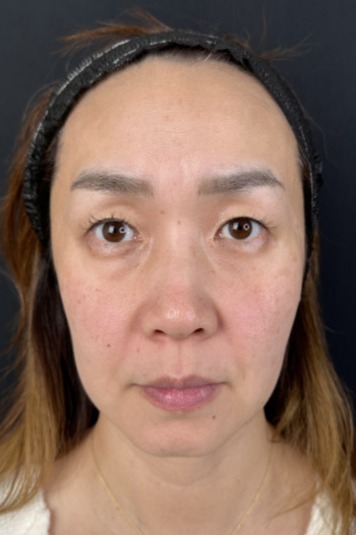 Preoperative Condition Part 1