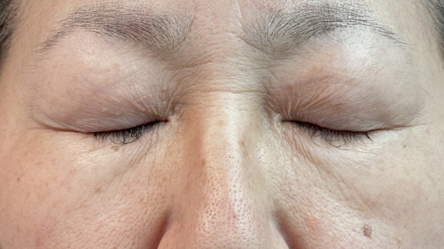 Preoperative Condition Part 1