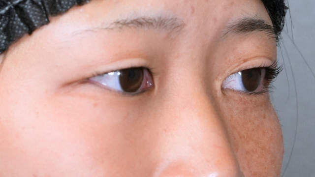 Preoperative Condition Part 1