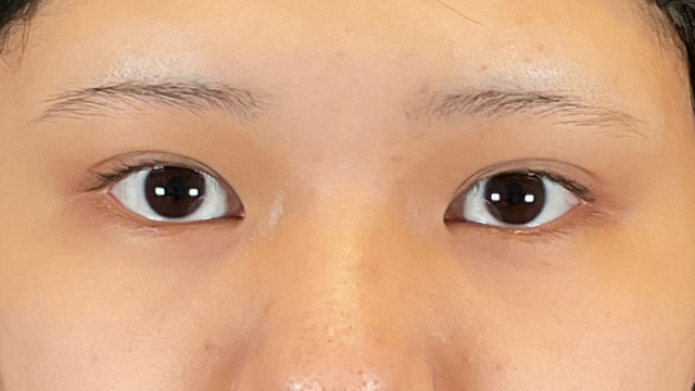 Preoperative Condition Part 1