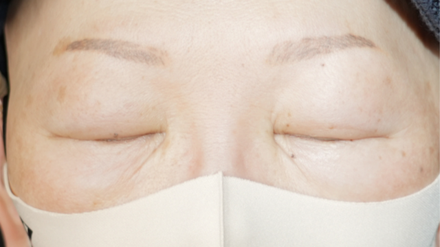 Preoperative Condition Part 1