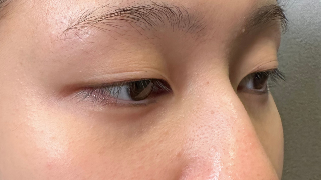 Preoperative Condition Part 1