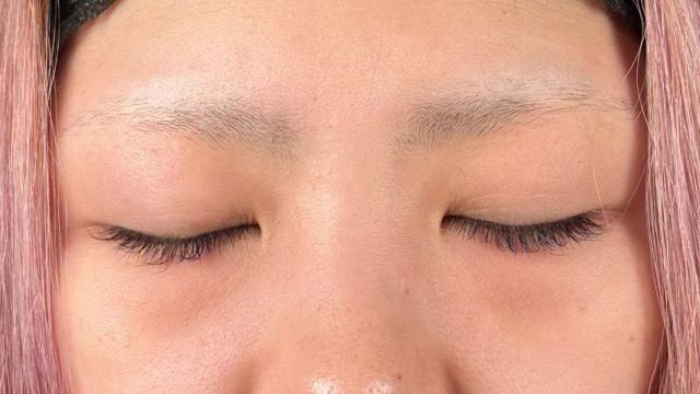 Preoperative Condition Part 1