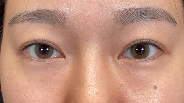 Preoperative Condition Part 1