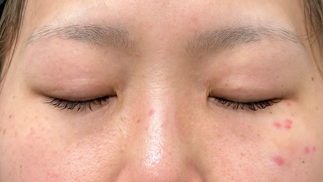 Preoperative Condition Part 1