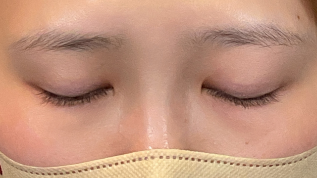 Preoperative Condition Part 1