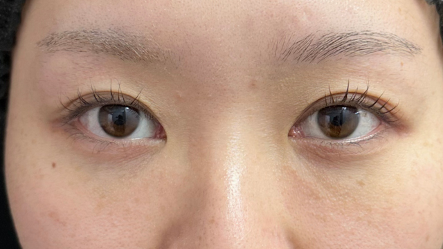 Preoperative Condition Part 1