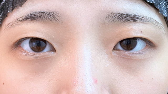 Preoperative Condition Part 1