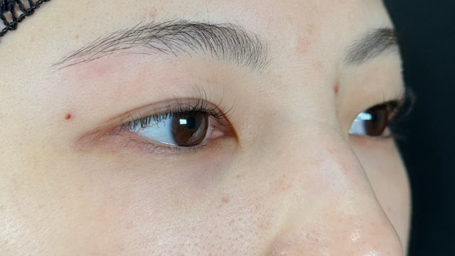 Preoperative Condition Part 1