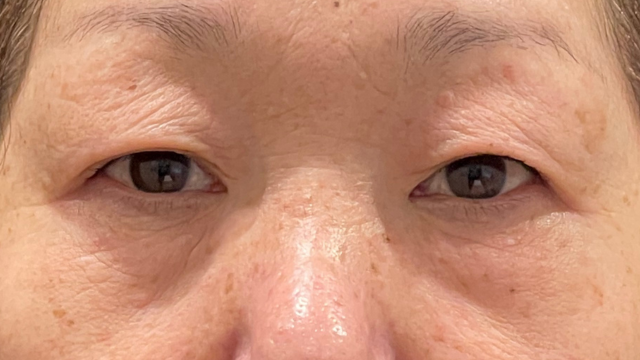 Preoperative Condition Part 1